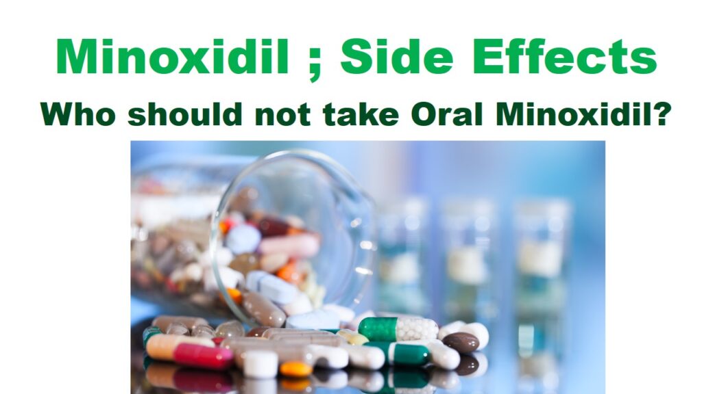 Minoxidil; Side Effects